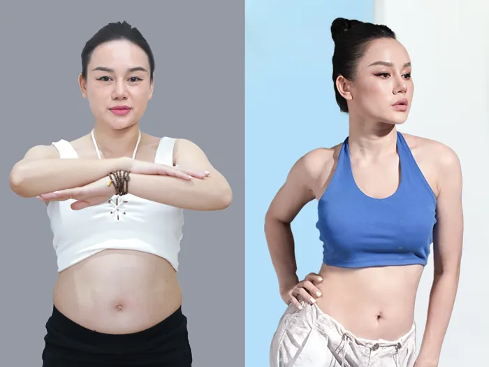 khách hàng sở hữu vòng eo con kiến sau khi hút mỡ