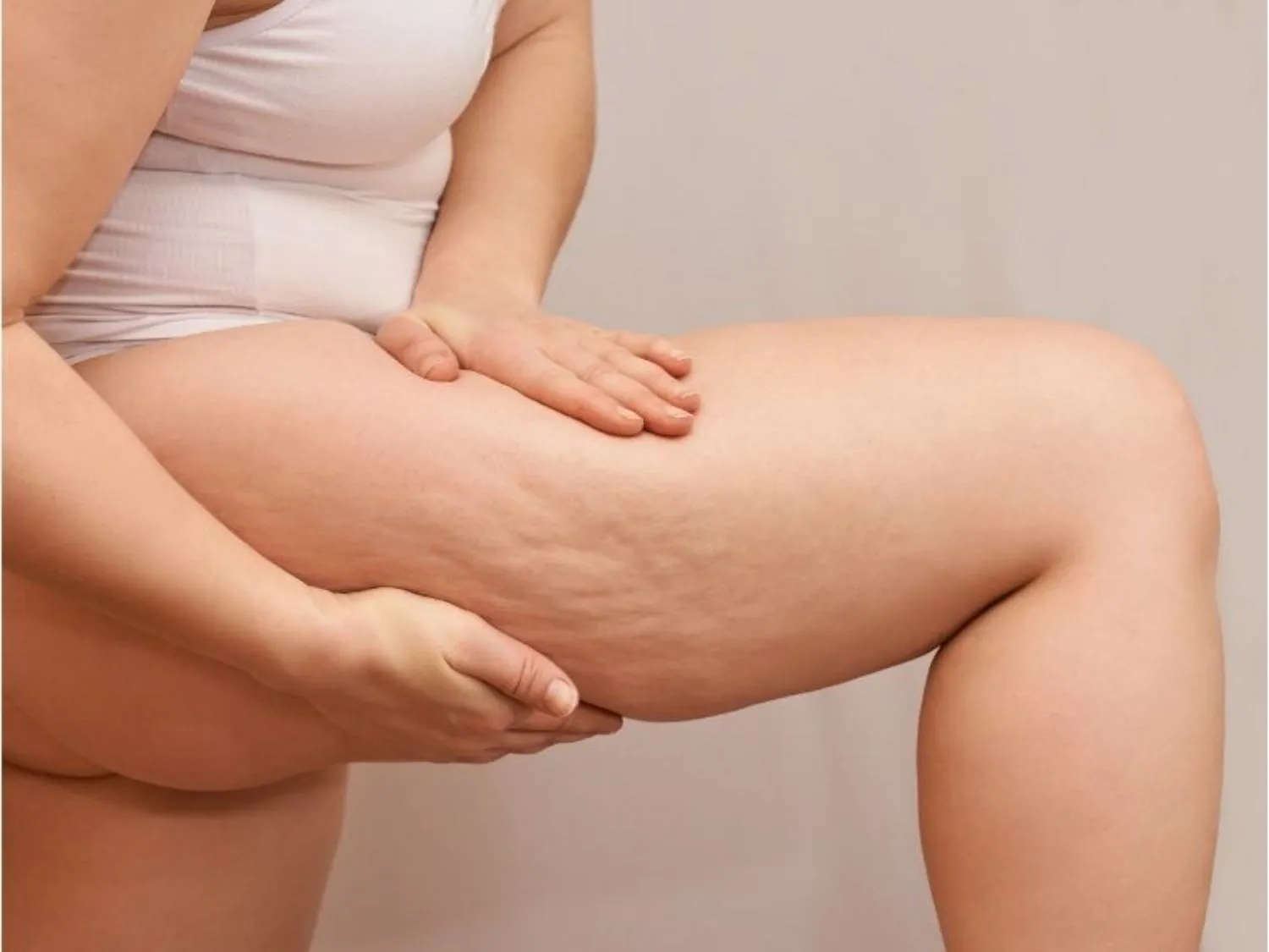 tình trạng mỡ Đùi trong chảy xệ nên cân nhắc hút mỡ để triệt tiêu