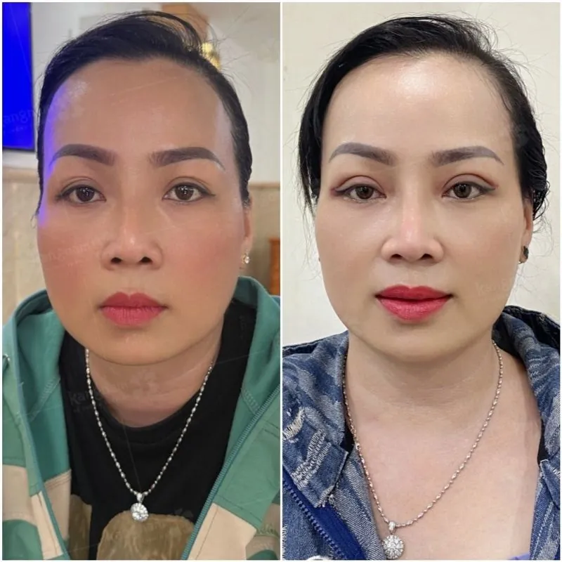 Mát 2 mí sắc nét, nếp mí đều