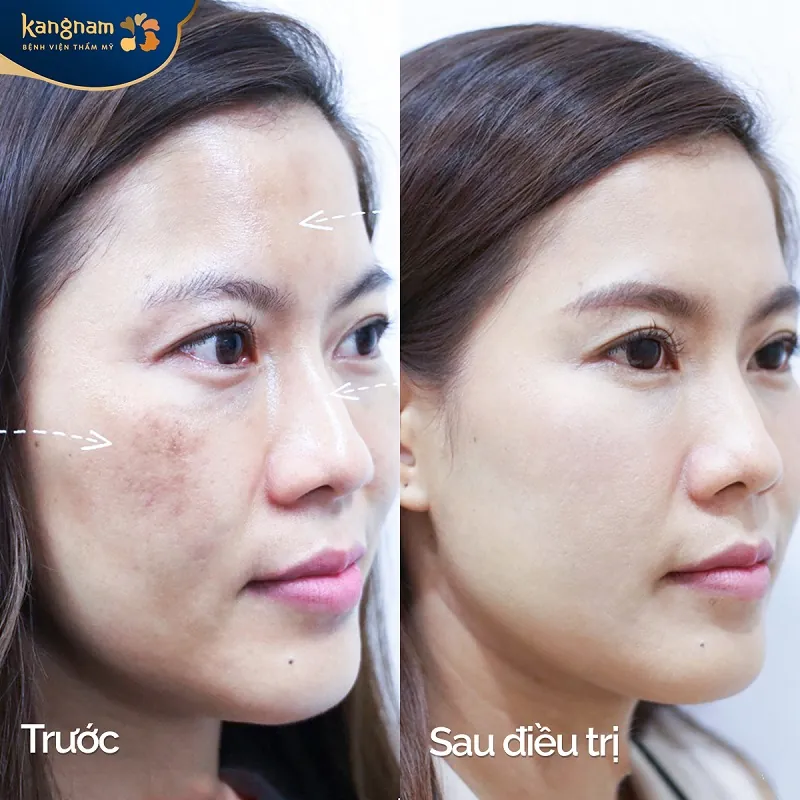 Làn da của khách hàng đều màu, sáng mịn