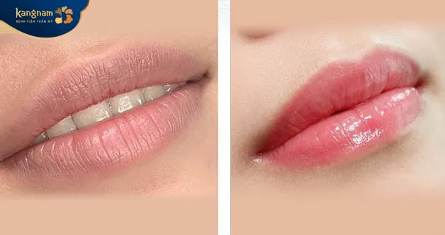 Quá trình khử thâm môi chuẩn Y khoa, đảm bảo an toàn