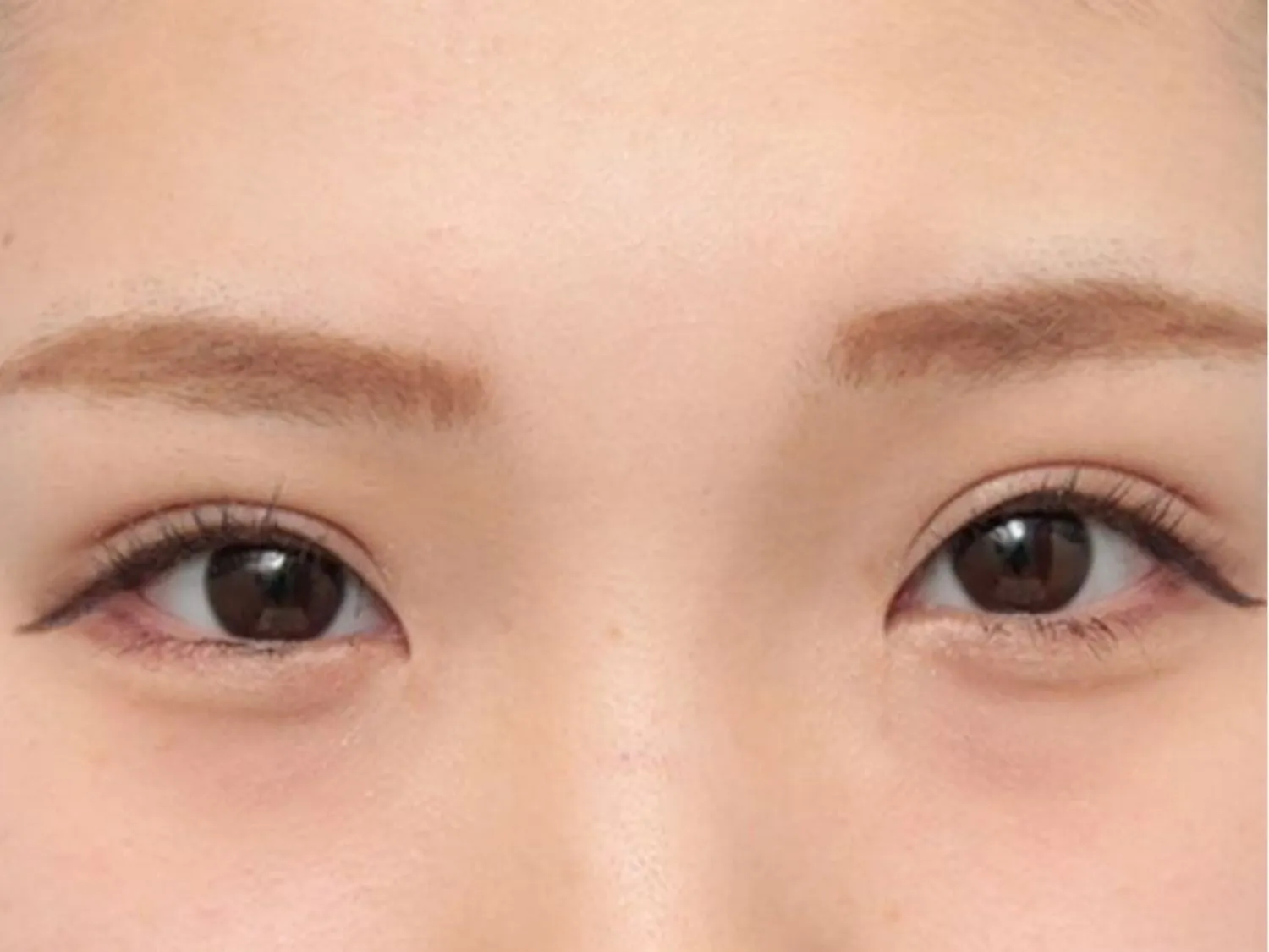 Gen di truyền cũng quyết định hình dáng mắt