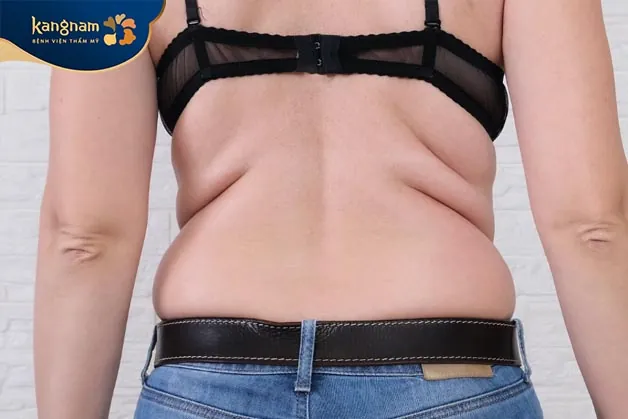 Một số người có xu hướng tích tụ mỡ ở một số vùng cụ thể trên cơ thể do di truyền