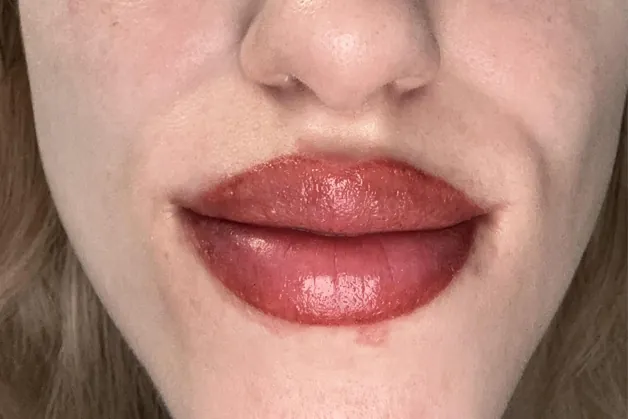 Môi bị lộ viền, lem viền