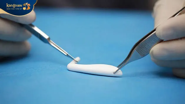 Sụn Nanoform là loại sụn cao cấp được làm từ ePTFE