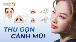 Thu gọn cánh mũi tự nhiên