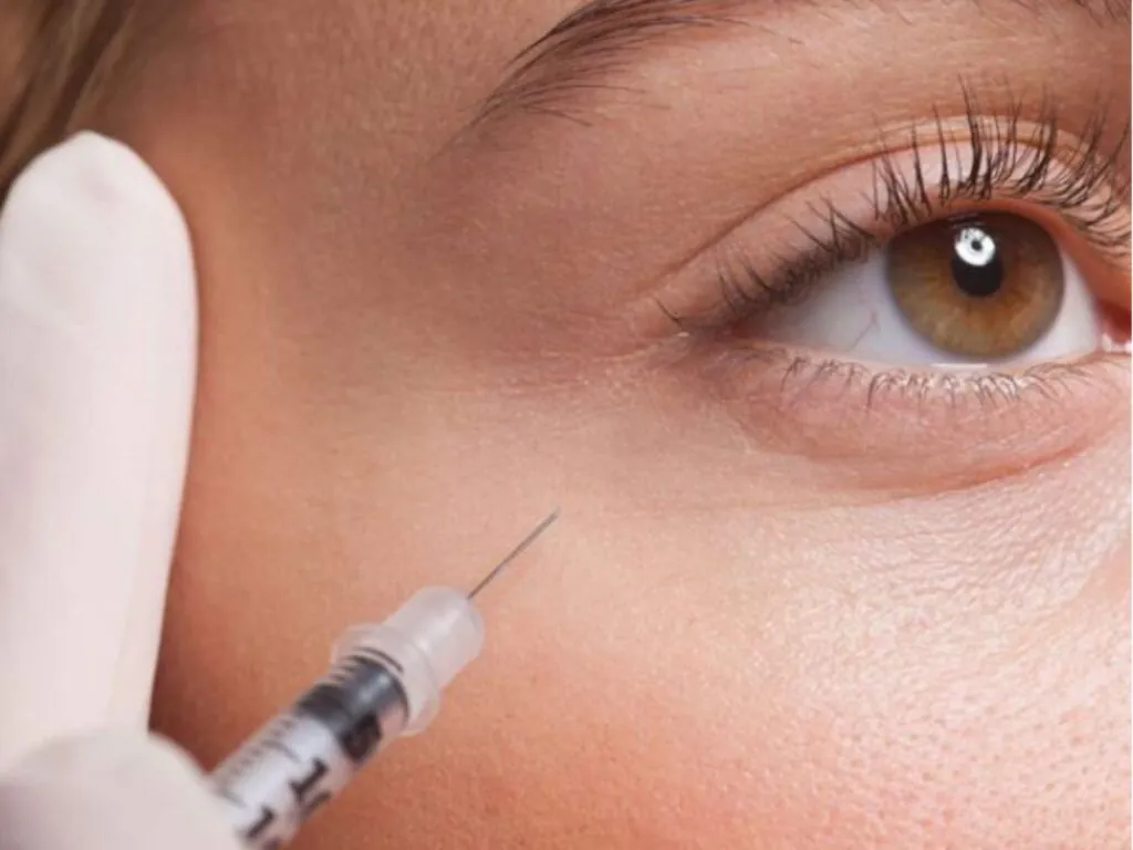 Chi phí tiêm làm đầy hốc mắt phụ thuộc từng cơ sở