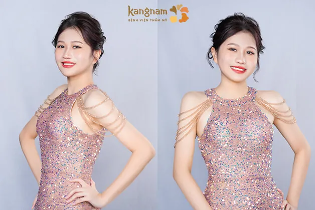 Sự thay đổi ngoạn mục của Xuân Mai sau khi “lột xác” thành công