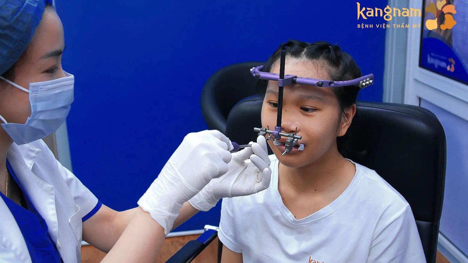 Xuân Mai đeo khí cụ kéo giãn xương hàm đặc biệt