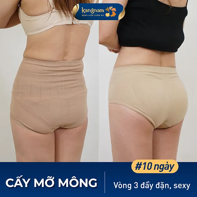 Hết mông lớp, sở hữu vòng 3 tròn trịa