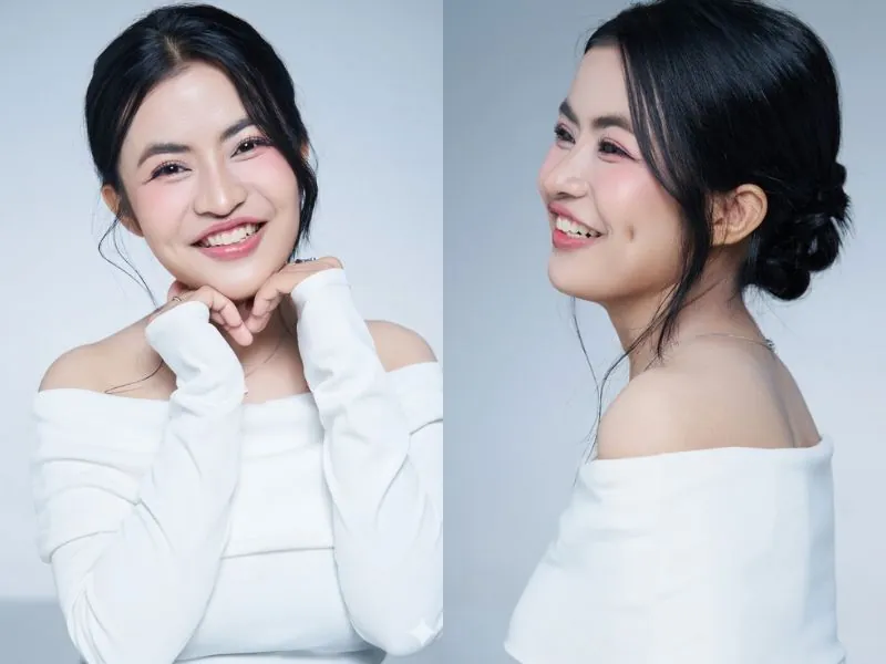 Kết quả sau khi cấy mỡ mặt của Trương Thị Trà My tại Bệnh viện Thẩm mỹ Kangnam. Gương mặt đã trở nên đầy đặn, trẻ trung và rạng rỡ hơn hẳn. Các vùng hốc hác đã được làm đầy tự nhiên, tổng thể khuôn mặt cân đối, nếp mí mắt đều đẹp, giúp nụ cười tự tin và rạng rỡ.