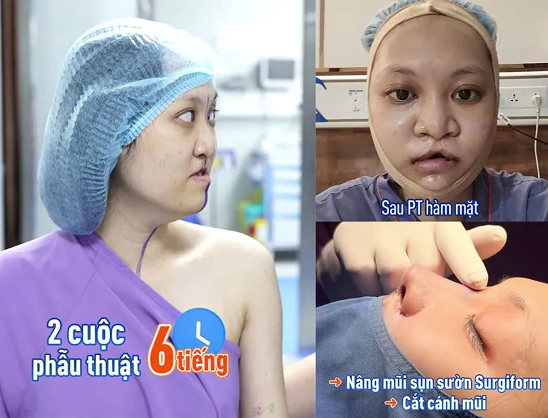 Tình trạng khuôn mặt nhiều khuyết điểm của Minh Xuân trước phẫu thuật