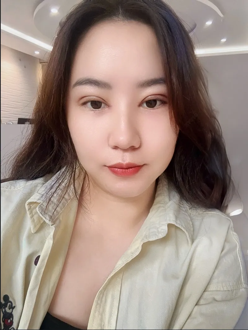 Sau 7 ngày nếp mí đã hết sưng và tự nhiên hơn