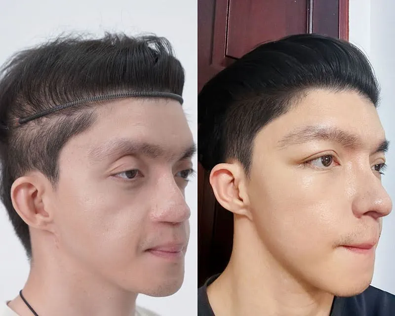 Sự thay đổi ngoạn mục của chàng trai “Avatar”