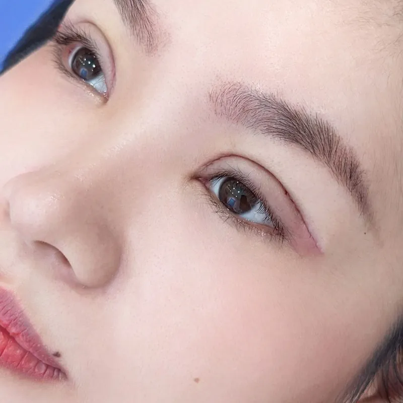 Cắt mí tại Kangnam giúp khách hàng sở hữu mắt hai mí rõ nét, hài hòa và tự nhiên