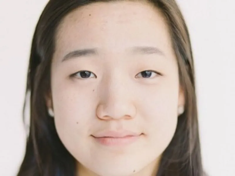 Sống mũi thấp, bè to 