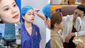 cắt mí tại Kangnam TPHCM