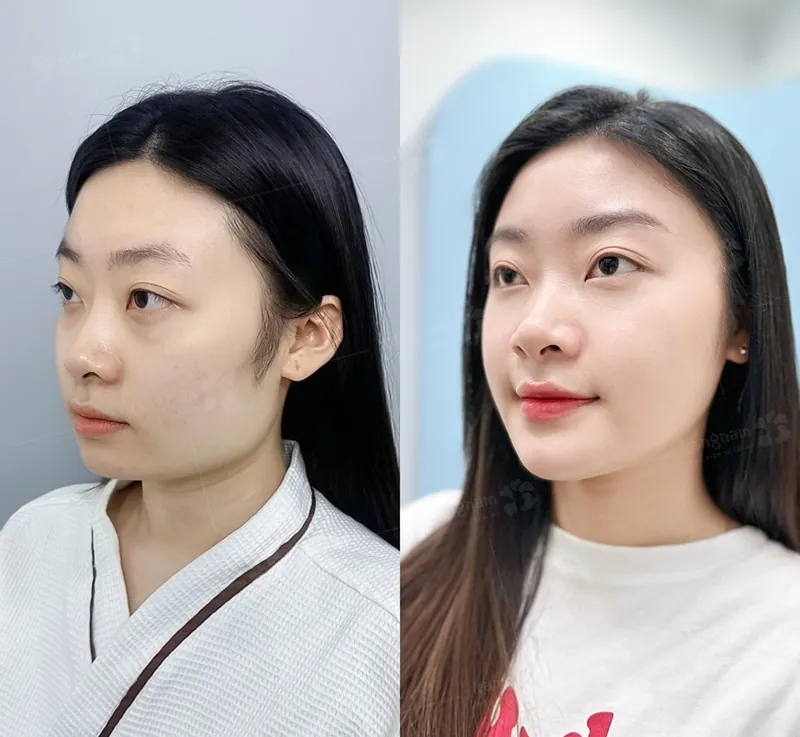 Người có góc hàm to, thô cứng 