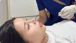 nâng mũi ở đâu đẹp tphcm