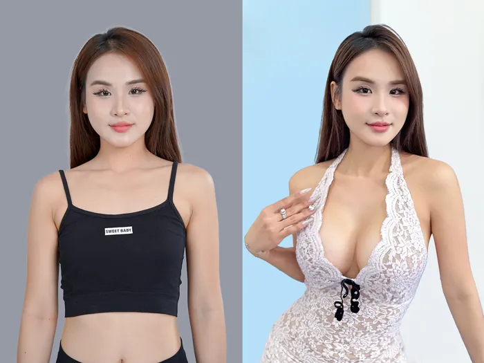 Sở hữu vòng 1 cân đối, tự nhiên với dịch vụ nâng ngực 4D