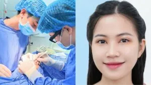 Cắt mí có gây mê không? Gây tê hay gây mê cái nào an toàn hơn?