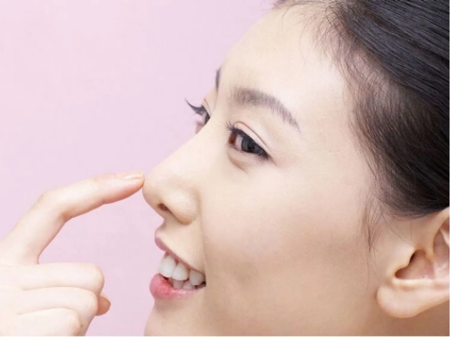 ảnh mô tả da mũi mỏng là tình trạng lớp da phủ sống mũi và đầu mũi có độ dày mô mềm thấp