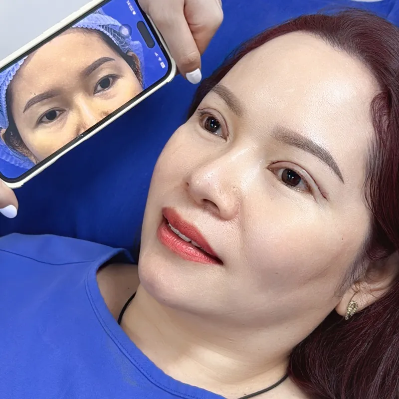 Giá cắt mí Hàn Quốc trên thị trường khá cao dao động lên tới hàng chục triệu đồng