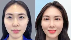 Giá cắt mí Mini Deep