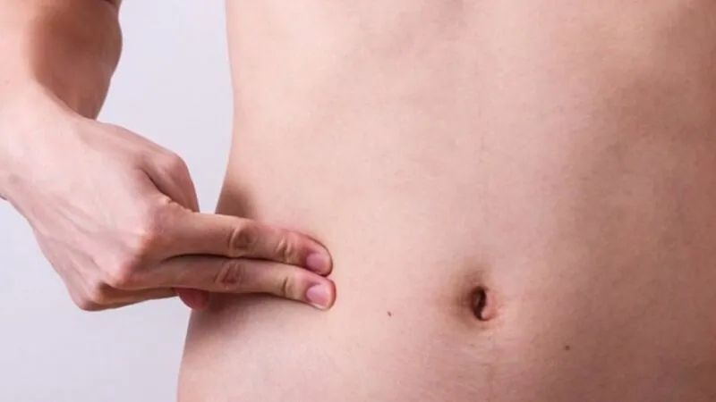 Cứng bụng sau hút mỡ thường do bị phù nề, tụ dịch dấu hiệu nhân biết cơ thể đang hồi phục