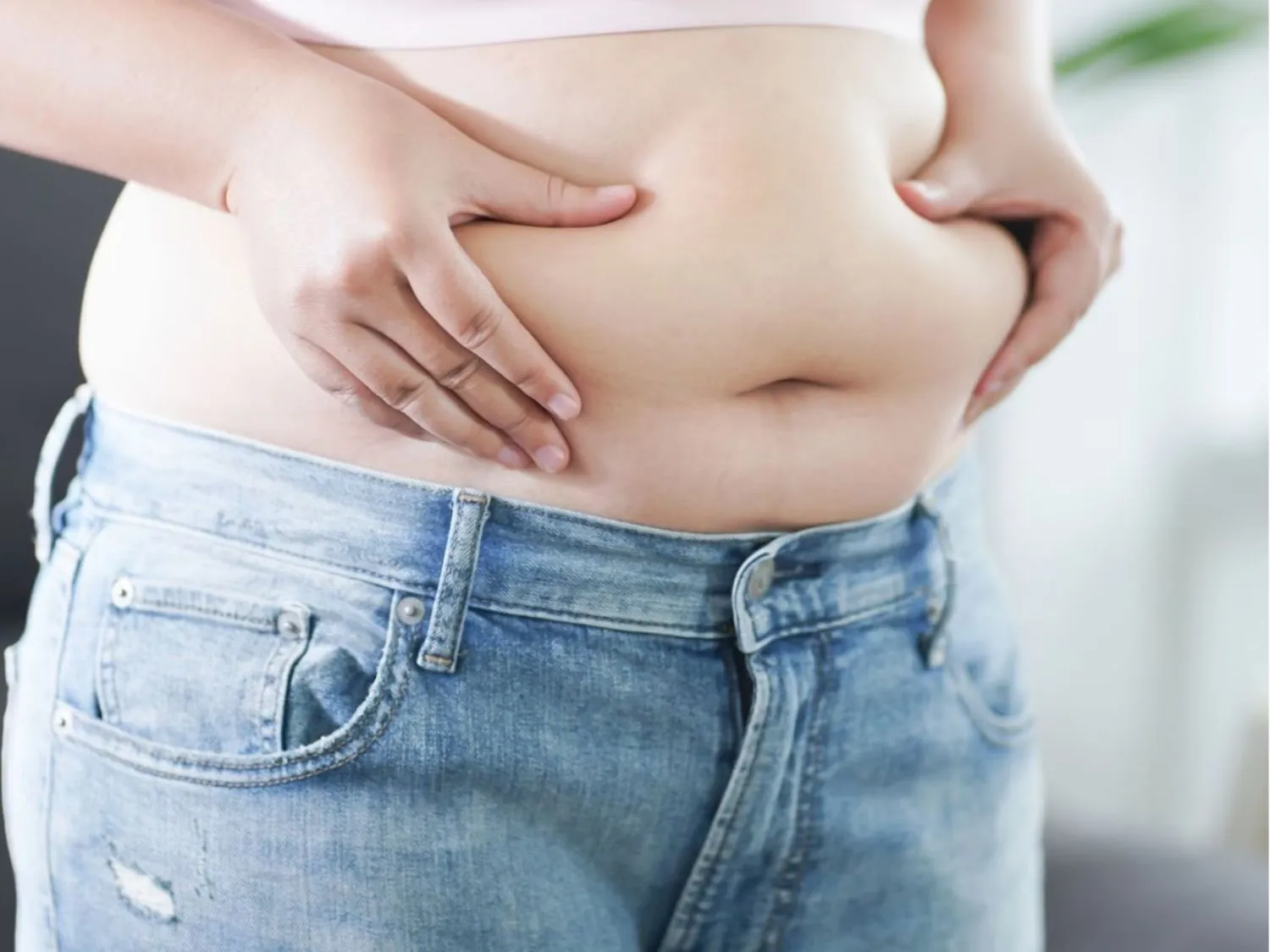 tình trạng mỡ bụng trên khiến nhiều người tự ti