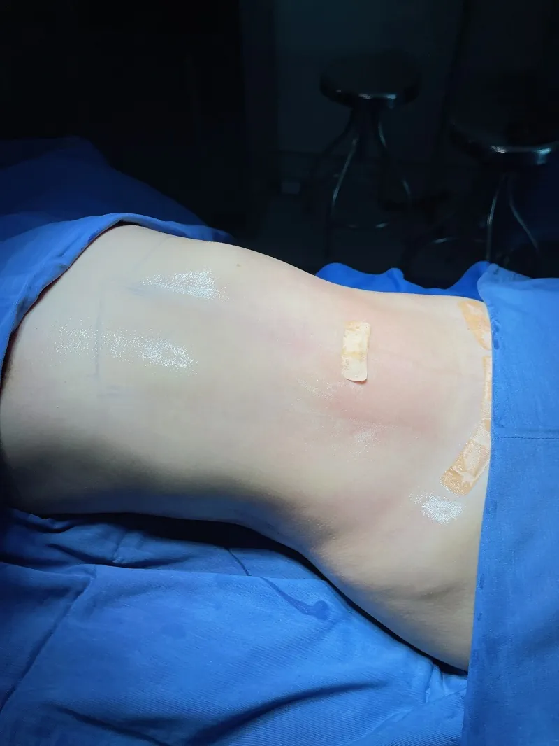 Kiểm soát tốt tình trạng sưng nề giúp giảm cảm giác đau nhức sau phẫu thuật.