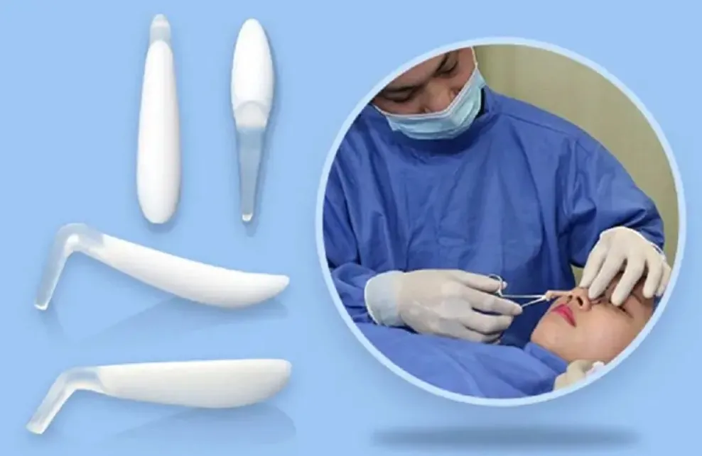 Nâng mũi đặt sụn Cần vài tuần đến vài tháng để mũi ổn định hoàn toàn