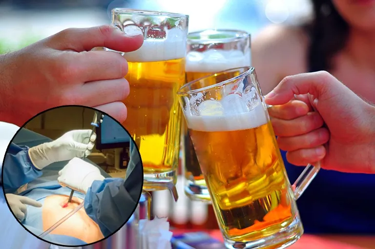 Tuyệt đối không uống rượu bia ít nhất 1 tháng sau hút mỡ để tránh làm chậm vết thương