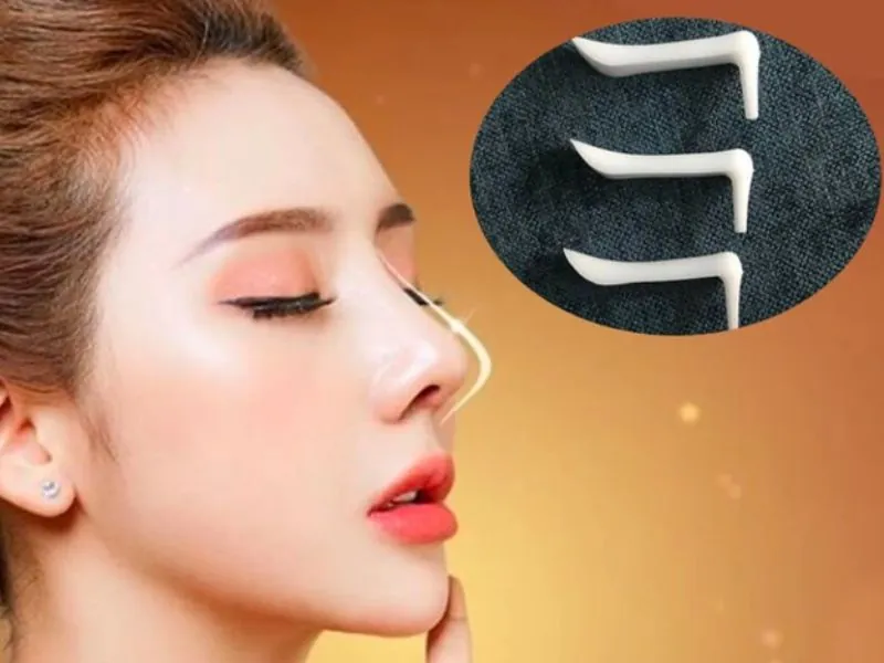 Sụn nâng mũi có thể bị thấp xuống theo thời gian, đặc biệt là khi về già