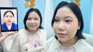Tạm biệt mí lót, mí lệch: Thúy Hằng tự tin hơn sau cắt mí tại Kangnam Hà Nội