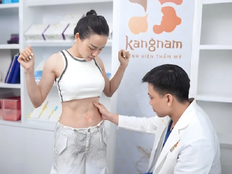 Kết quả hút mỡ sau 6 tháng, vết sẹo nhỏ và mờ