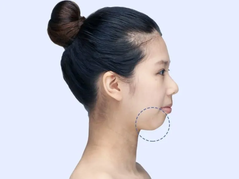 Tỉ lệ vàng khuôn mặt trán mũi cằm đối cho người cằm ngắn.