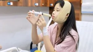 Gọt hàm có ảnh hưởng ăn nhai không? Sau bao lâu ăn uống bình thường