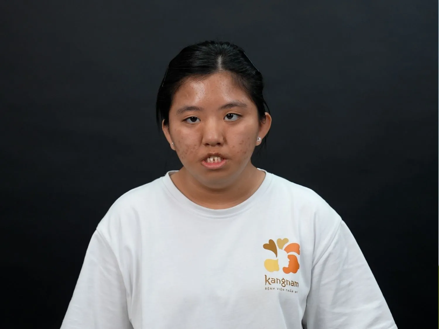 Ngoại hình của Kim Ngân khi đến với Hành trình Lột xác