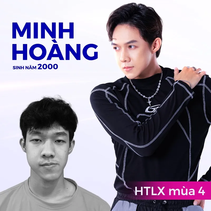 Chàng dancer lột xác như hot boy sau khi được phẫu thuật chỉnh hình miễn phí tại Kangnam