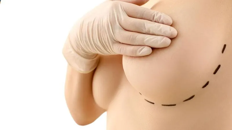 Túi ngực tạo áp lực lên da và cơ ngực, không truyền lực xuyên qua xương sườn vào tim.