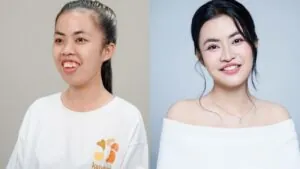 Người thay đổi nhiều nhất Hành Trình Lột Xác mùa 7 là ai? Nhìn lại 120 ngày lột xác toàn diện?