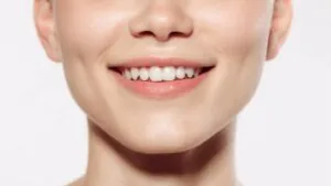 Trượt cằm là gì? Ưu điểm xương tự thân & Lộ trình hồi phục