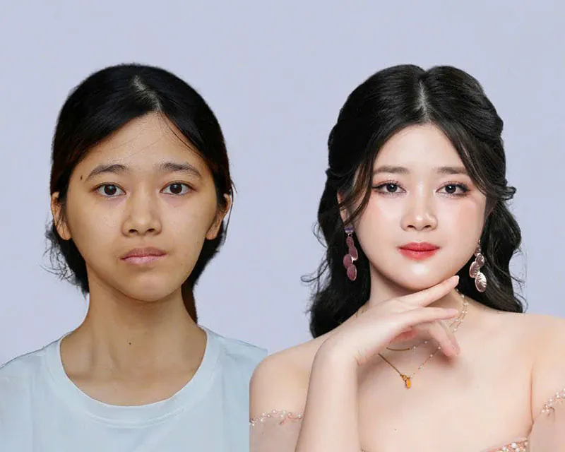 Thu Hường - Cô gái mặt lõm lột xác ngoạn mục