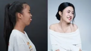 Trương Thị Trà My lột xác hết bao nhiêu tiền? Chi phí để được như Trà My Hành trình Lột xác