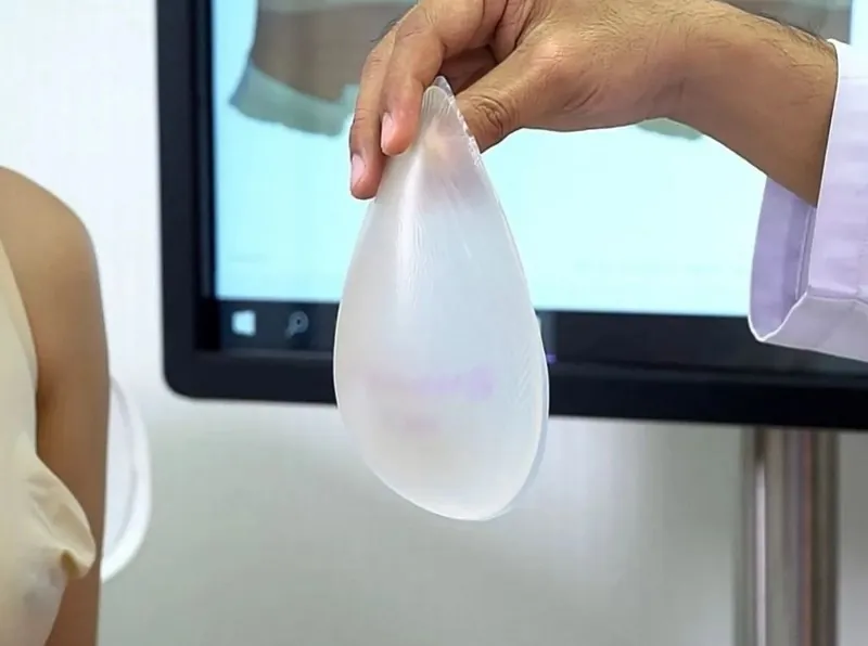 Cấu tạo túi nâng ngực hình giọt nước vỏ nhám cao cấp.