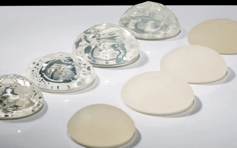 Túi độn quá lớn có thể gây hoại tử ngực