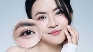 Tạo mắt 2 mí như Trà My khác gì so với cắt mí thông thông thường