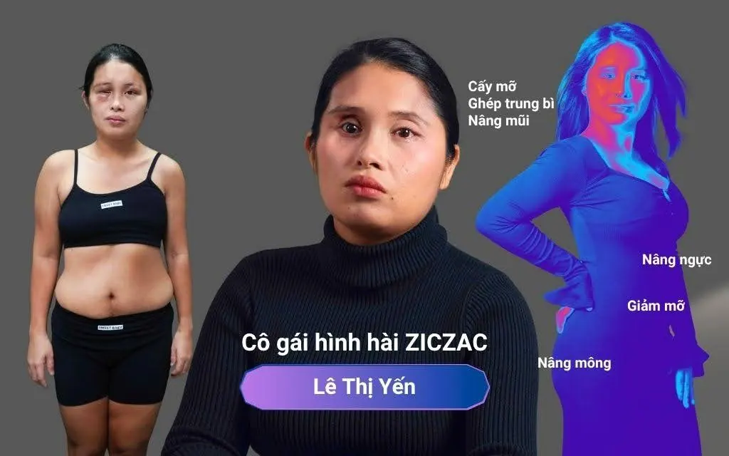 Trước và sau tái cấu trúc vóc dáng - Lê Thị Yến Hành Trình Lột Xác mùa 7 do BS Hoàng Văn Tiệm thực hiện