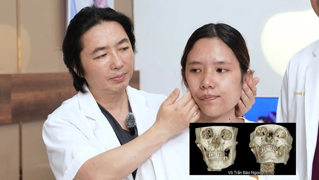 Võ Trần Bảo Ngọc với gương mặt lệch nhiều năm chưa tìm được phương pháp